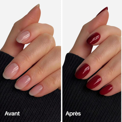 Cherry Nail Pen